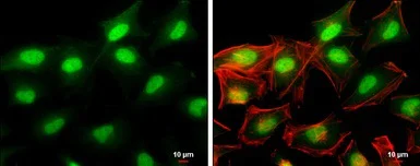 Immunocytochemistry/ Immunofluorescence - Anti-HDAC2 antibody (AB137364)
