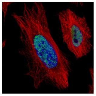 Immunocytochemistry/ Immunofluorescence - Anti-HDAC2 antibody (AB137364), expandable thumbnail