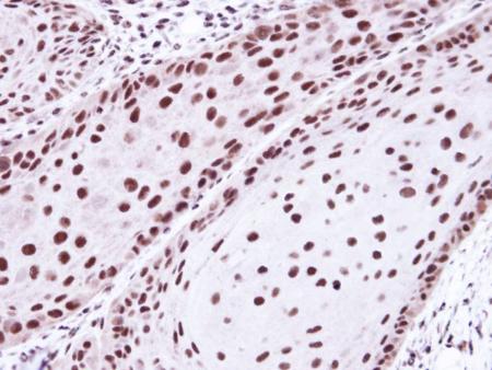 Immunohistochemistry (Formalin/PFA-fixed paraffin-embedded sections) - Anti-HDAC2 antibody (AB137364), expandable thumbnail