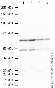 Western blot - Anti-HDAC2 antibody (AB16032)