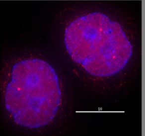 Immunocytochemistry/ Immunofluorescence - Anti-HDAC2 antibody (AB7029)