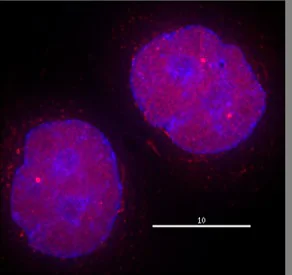 Immunocytochemistry/ Immunofluorescence - Anti-HDAC2 antibody (AB7029)