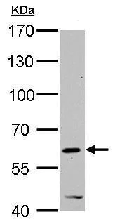 Western blot - Anti-HDAC2 antibody - C-terminal (AB227149)