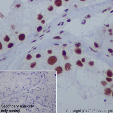 Immunohistochemistry (Formalin/PFA-fixed paraffin-embedded sections) - Anti-HDAC2 antibody [EPR20117] (ab219053), expandable thumbnail
