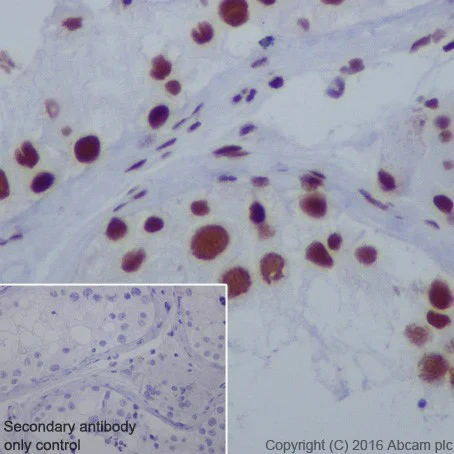 Immunohistochemistry (Formalin/PFA-fixed paraffin-embedded sections) - Anti-HDAC2 antibody [EPR20117] (AB219053)