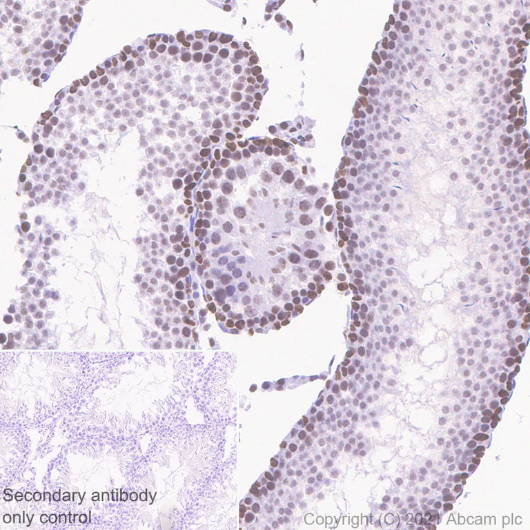 Immunohistochemistry (Formalin/PFA-fixed paraffin-embedded sections) - Anti-HDAC2 antibody [Y461] (AB32117)