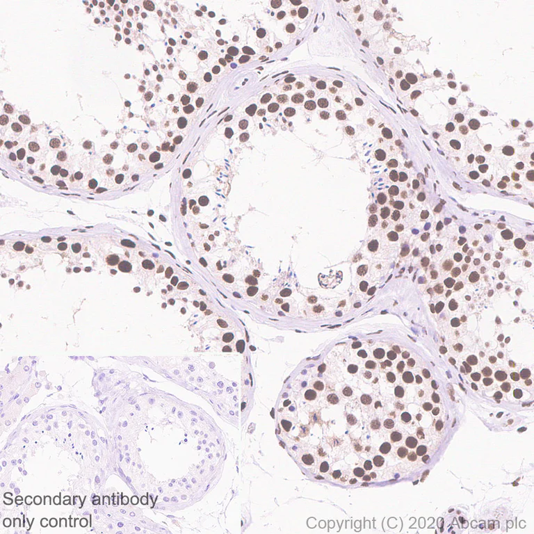 Anti-HDAC2 antibody [Y461] (ab32117) | Abcam