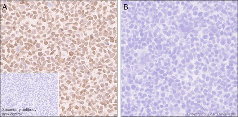 Immunohistochemistry (Formalin/PFA-fixed paraffin-embedded sections) - Anti-HDAC2 antibody [Y461] (AB32117)