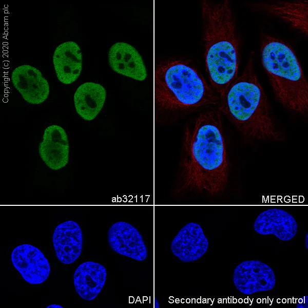 Immunocytochemistry/ Immunofluorescence - Anti-HDAC2 antibody [Y461] - BSA and Azide free (AB213700)
