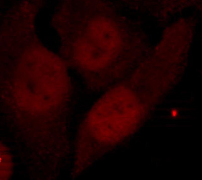 Immunocytochemistry/ Immunofluorescence - Anti-HDAC2 (phospho S394) antibody (AB75602)