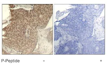 Immunohistochemistry (Formalin/PFA-fixed paraffin-embedded sections) - Anti-HDAC2 (phospho S394) antibody (AB75602)
