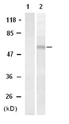 Western blot - Anti-HDAC2 (phospho S394) antibody (AB75602)