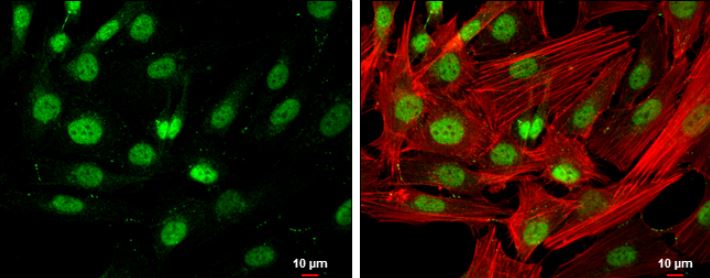 Immunocytochemistry/ Immunofluorescence - Anti-HDAC3 antibody (AB137704)
