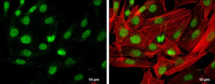 Immunocytochemistry/ Immunofluorescence - Anti-HDAC3 antibody (AB137704)