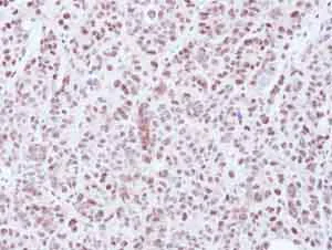 Immunohistochemistry (Formalin/PFA-fixed paraffin-embedded sections) - Anti-HDAC3 antibody (AB137704)