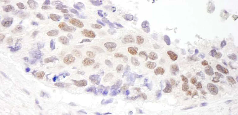 Immunohistochemistry (Formalin/PFA-fixed paraffin-embedded sections) - Anti-HDAC3 antibody (AB264126)