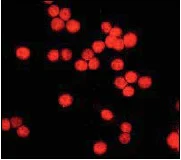 Immunocytochemistry/ Immunofluorescence - Anti-HDAC3 antibody [Y415] (AB32369)