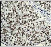 Immunohistochemistry (Formalin/PFA-fixed paraffin-embedded sections) - Anti-HDAC3 antibody [Y415] - BSA and Azide free (AB219376)