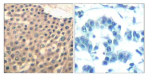 Immunohistochemistry (Formalin/PFA-fixed paraffin-embedded sections) - Anti-HDAC4 + 5 + 9 antibody (AB131524)