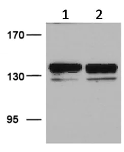 Western blot - Anti-HDAC4 + 5 + 9 antibody (AB131524)