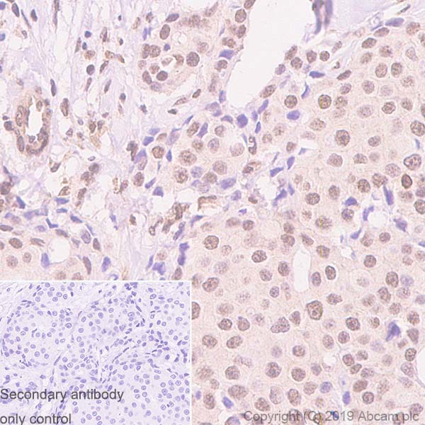 Immunohistochemistry (Formalin/PFA-fixed paraffin-embedded sections) - Anti-HDAC4 + 5 + 9 antibody [EPR19010-77] (AB195241), expandable thumbnail
