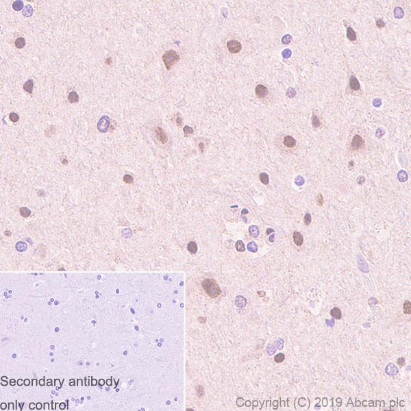 Immunohistochemistry (Formalin/PFA-fixed paraffin-embedded sections) - Anti-HDAC4 + 5 + 9 antibody [EPR19010-77] (AB195241), expandable thumbnail