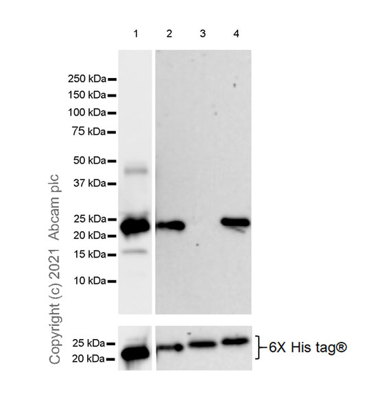 Western blot - Anti-HDAC4 + 5 + 9 antibody [EPR19010-77] (AB195241), expandable thumbnail