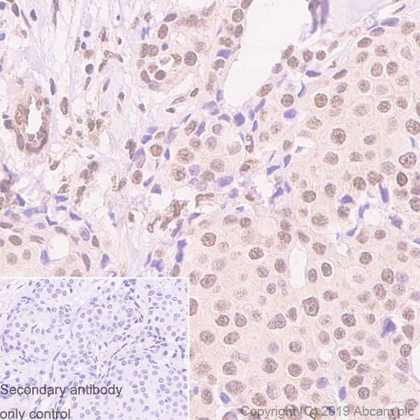 Immunohistochemistry (Formalin/PFA-fixed paraffin-embedded sections) - Anti-HDAC4 + 5 + 9 antibody [EPR19010-77] - BSA and Azide free (AB271355)