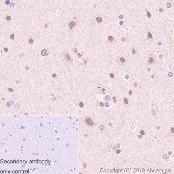 Immunohistochemistry (Formalin/PFA-fixed paraffin-embedded sections) - Anti-HDAC4 + 5 + 9 antibody [EPR19010-77] - BSA and Azide free (AB271355)