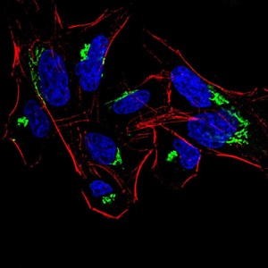 Immunocytochemistry/ Immunofluorescence - Anti-HDAC4 antibody [7E2E6] (AB234084), expandable thumbnail
