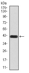 Western blot - Anti-HDAC4 antibody [7E2E6] (AB234084), expandable thumbnail