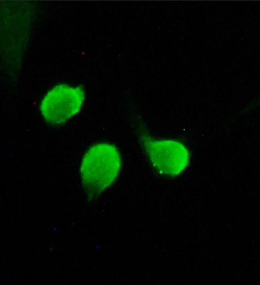 Immunocytochemistry/ Immunofluorescence - Anti-HDAC4 antibody (AB12172)