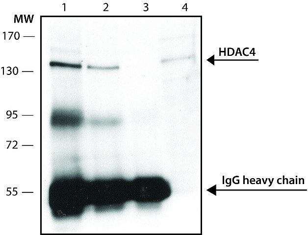 Immunoprecipitation - Anti-HDAC4 antibody (AB12172), expandable thumbnail