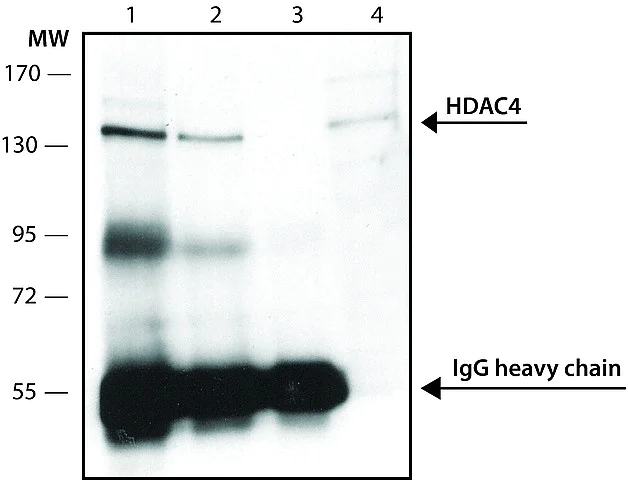 Immunoprecipitation - Anti-HDAC4 antibody (AB12172)