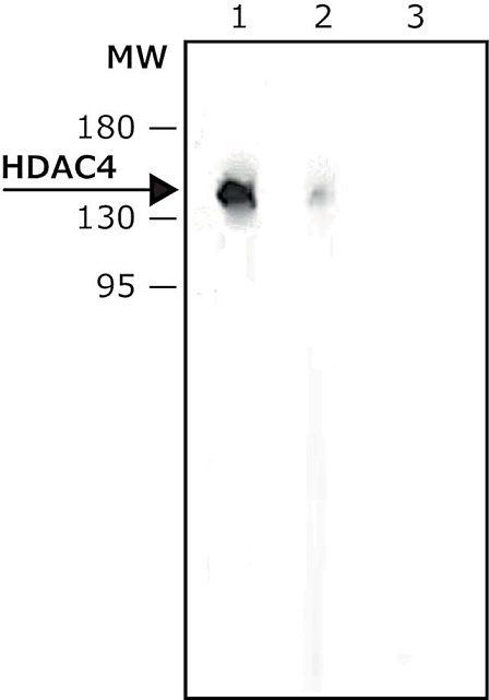 Western blot - Anti-HDAC4 antibody (AB12172), expandable thumbnail