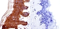 Immunohistochemistry (Formalin/PFA-fixed paraffin-embedded sections) - Anti-HDAC4 antibody (AB16339)