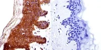 Immunohistochemistry (Formalin/PFA-fixed paraffin-embedded sections) - Anti-HDAC4 antibody (AB16339)