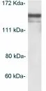 Western blot - Anti-HDAC4 antibody (AB16339)