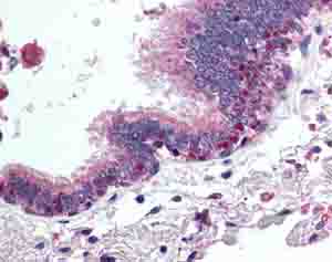 Immunohistochemistry (Formalin/PFA-fixed paraffin-embedded sections) - Anti-HDAC4 antibody (AB79521)