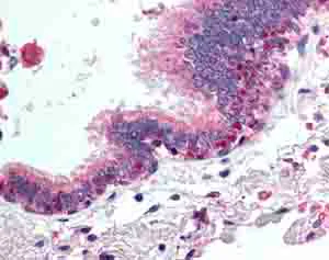 Immunohistochemistry (Formalin/PFA-fixed paraffin-embedded sections) - Anti-HDAC4 antibody (AB79521)