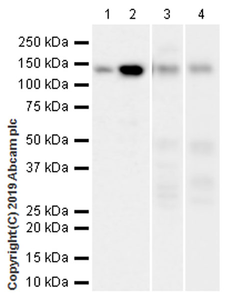 Western blot - Anti-HDAC4 antibody [EPR22937-157] (AB235583), expandable thumbnail