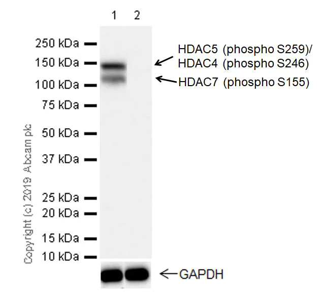 Western blot - Anti-HDAC4 (phospho S246) + HDAC5 (phospho S259) + HDAC7 (phospho S155) antibody [EPR22997-46] (AB240643)