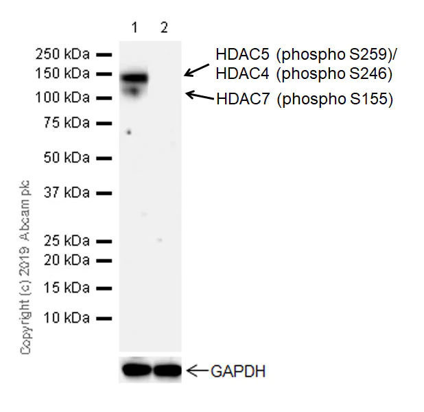 Western blot - Anti-HDAC4 (phospho S246) + HDAC5 (phospho S259) + HDAC7 (phospho S155) antibody [EPR22997-46] (AB240643)