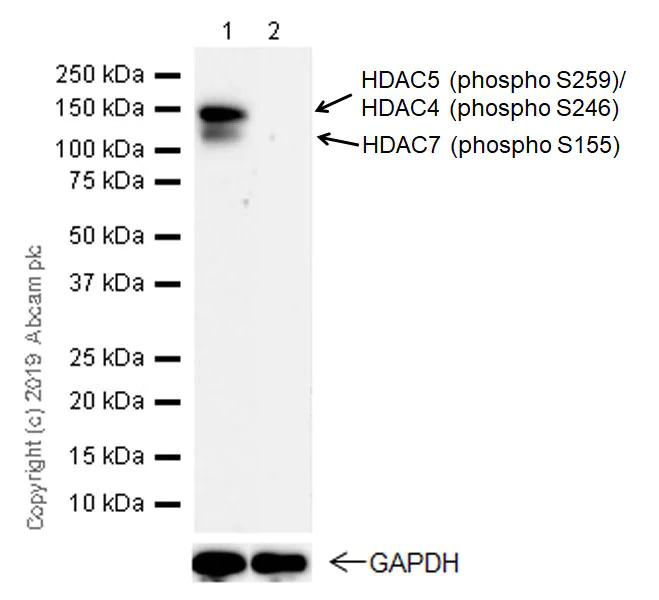 Western blot - Anti-HDAC4 (phospho S246) + HDAC5 (phospho S259) + HDAC7 (phospho S155) antibody [EPR22997-46] (AB240643)