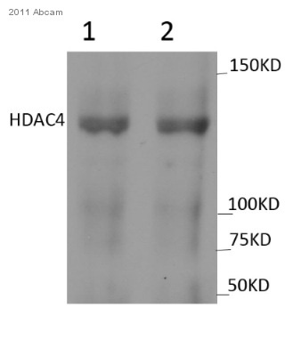 Western blot - Anti-HDAC4 (phospho S632) antibody (AB39408)