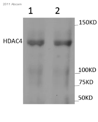 Western blot - Anti-HDAC4 (phospho S632) antibody (AB39408)