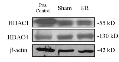 Western blot - Anti-HDAC4 (phospho S632) antibody (AB39408)
