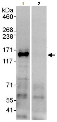 Immunoprecipitation - Anti-HDAC5 antibody (AB225906), expandable thumbnail