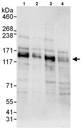 Western blot - Anti-HDAC5 antibody (AB225906), expandable thumbnail