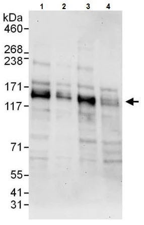 Western blot - Anti-HDAC5 antibody (AB225906)